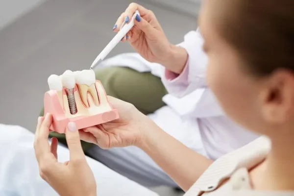 Exploring Dental Implant Solutions In Kansas City: A Comprehensive Guide