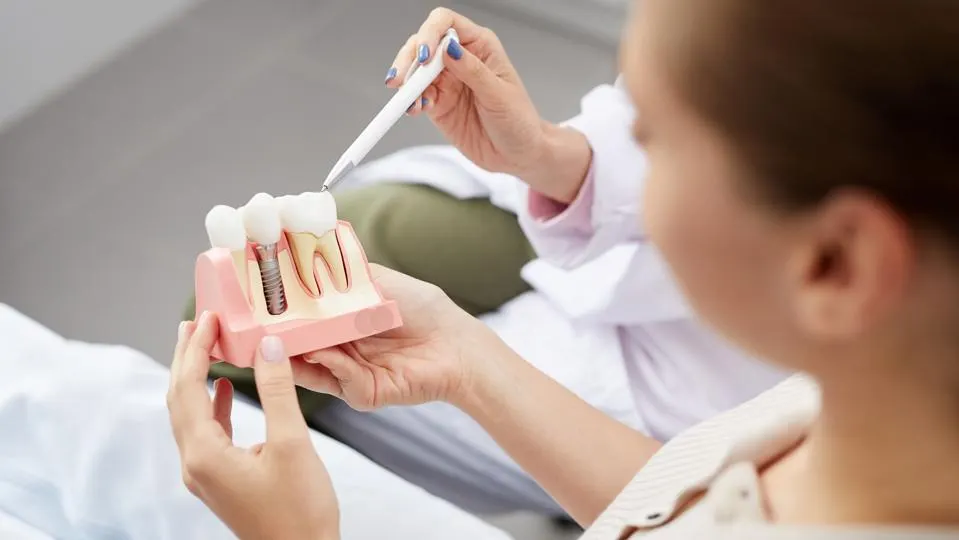 Exploring Dental Implant Solutions In Kansas City: A Comprehensive Guide